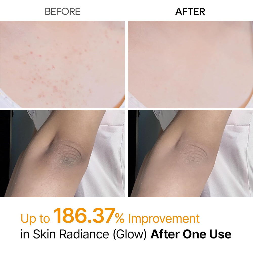 Peel Shot Kojic Spray