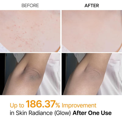 Peel Shot Kojic Spray